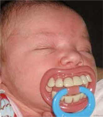 Duimzuigen Springerlink