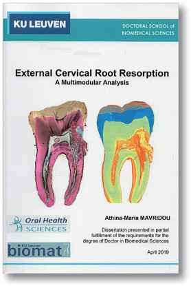 Externe Cervicale Wortelresorptie Een Multimodulaire Analyse Springerlink