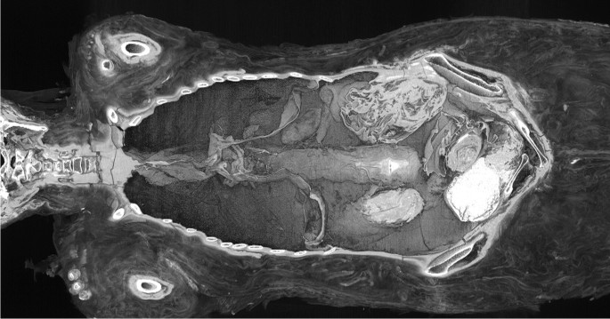The “pregnant mummy” from Warsaw reassessed: NOT pregnant. Radiological case study, literature review of ancient feti in Egypt and the pitfalls of archaeological and non-archaeological methods in mummy studies | Archaeological and