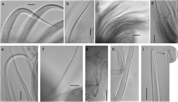 figure 32