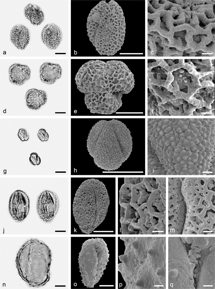 The Middle Miocene Palynofloras Of The Salihpasalar Lignite Mine Yatagan Basin Southwest Anatolia Environmental Characterisation And Comparison With Palynofloras From Adjacent Basins Springerlink