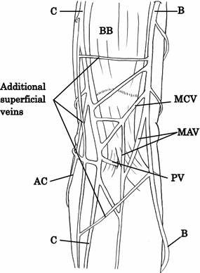 Topographical Anatomy Of Superficial Veins Cutaneous Nerves And Arteries At Venipuncture Sites In The Cubital Fossa Springerlink