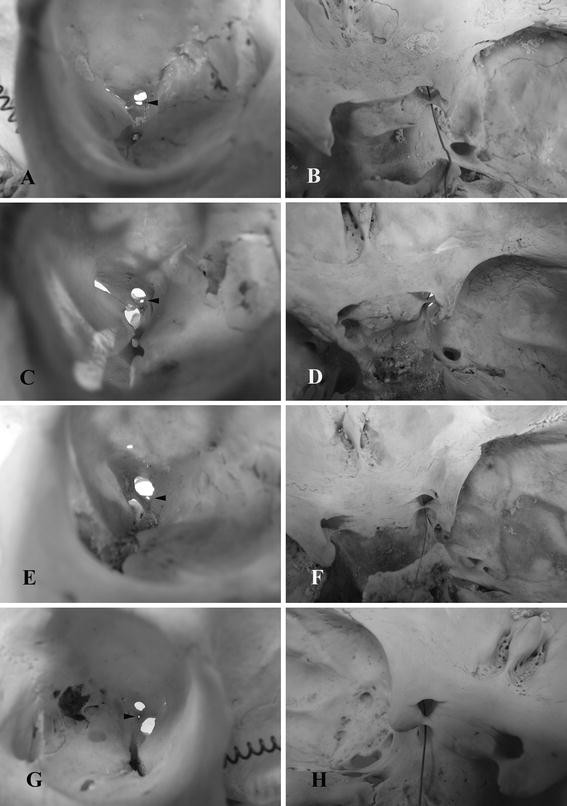 Osteologia e sindesmologia