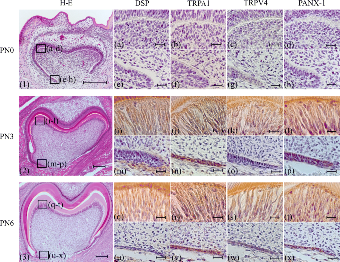 Developmental Studies On The Acquisition Of Perception Conducting Pathways Via Trp Channels In Rat Molar Odontoblasts Using Immunohistochemistry And Rt Qpcr Springerlink