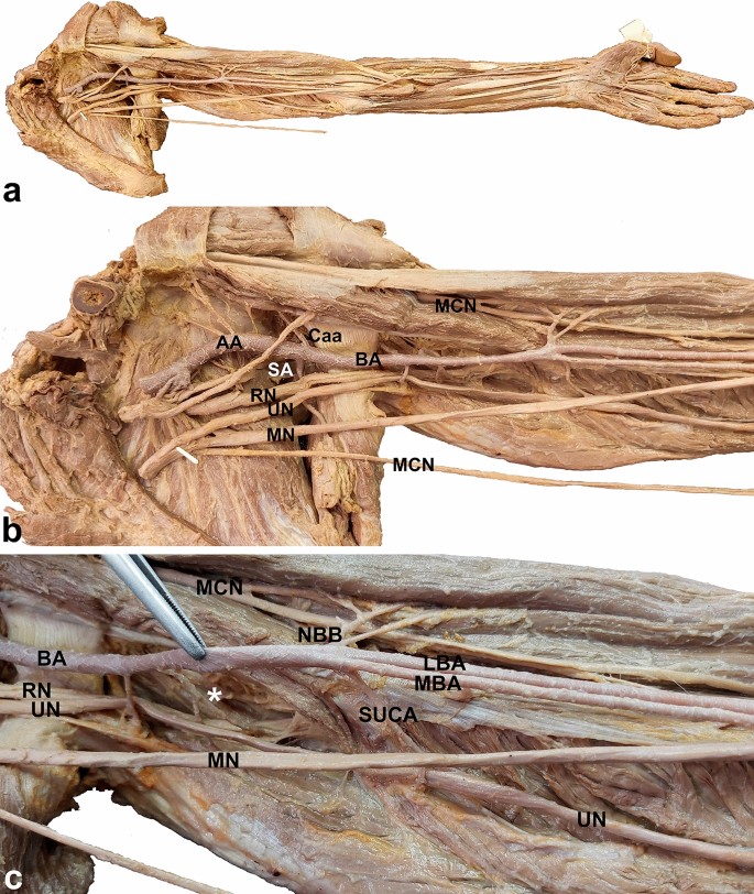 subscapular artery cadaver