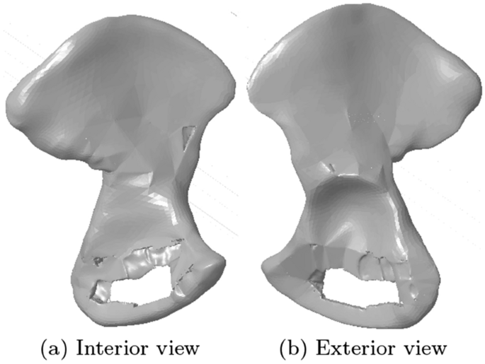 figure 15