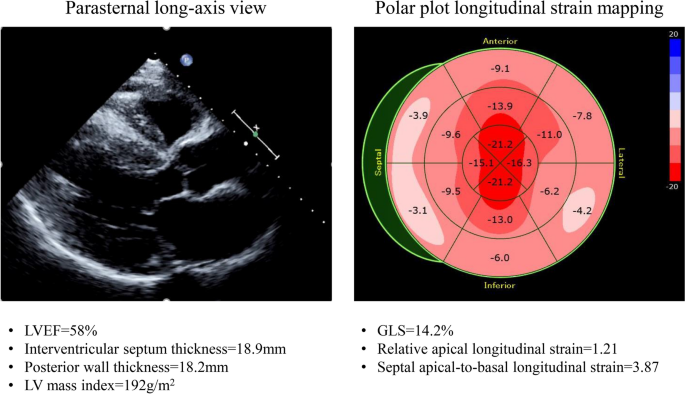 Impaired left ventricular global longitudinal strain is associated