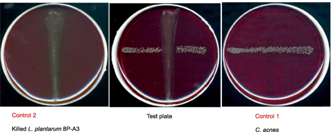 A New Approach To Harness Probiotics Against Common Bacterial Skin Pathogens Towards Living Antimicrobials Springerlink