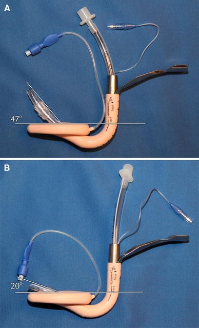 The FastrachTM Intubating Laryngeal Mask Airway®: an overview and update |  SpringerLink