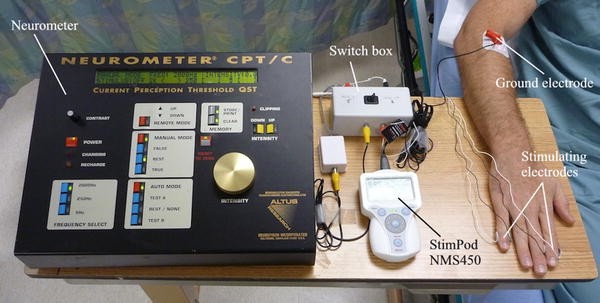 Чрезкожный нейростимулятор схема через. Нейростимулятор для проводниковой анестезии. Нейростимулятор для блокады периферических нервов. Нейростимулятор "Нейрон-2". Электрический нейростимулятор для блокад.