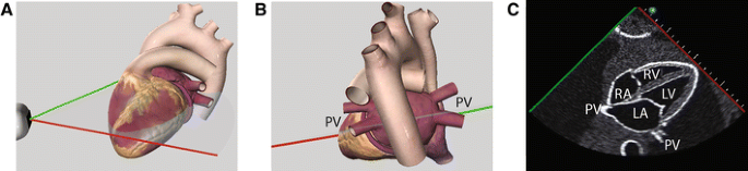 figure 19