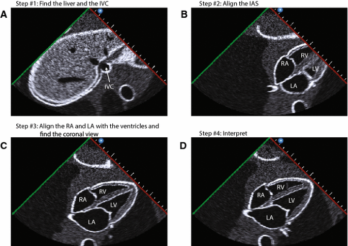 figure 20