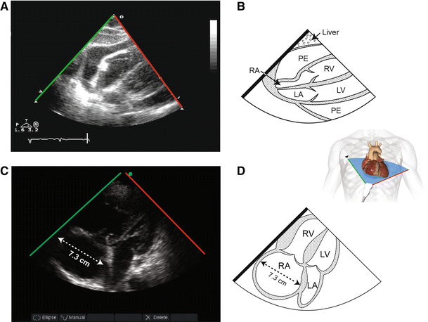 figure 22