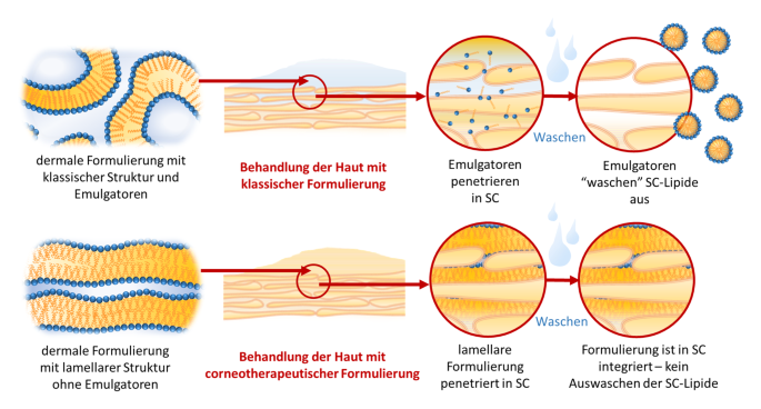 Corneotherapie – Pflege und Reparatur der Haut: präzise, effektiv und  nachhaltig | SpringerLink