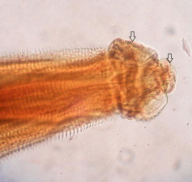Occurrence Of Gnathostoma Spinigerum In A Leopard Cat From Wayanad Wildlife Sanctuary Kerala Springerlink