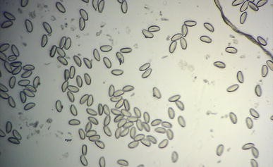 enterobius vermicularis kinder