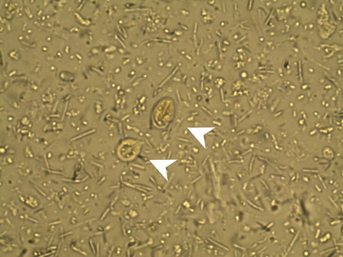 A trichocephalosis geohelmint pinworm transzfer