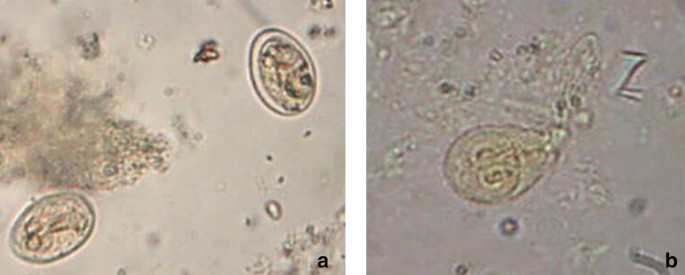 giardia cysts in stool images)