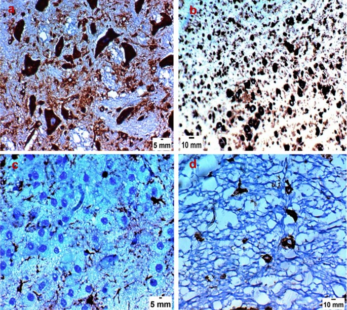 Effect Of Spiramycin Versus Aminoguanidine And Their Combined Use In Experimental Toxoplasmosis Springerlink