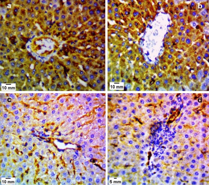 Effect Of Spiramycin Versus Aminoguanidine And Their Combined Use In Experimental Toxoplasmosis Springerlink