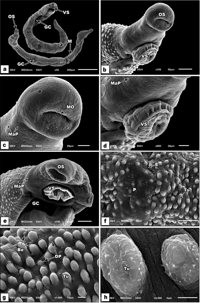 Antischistosomal effects of Ficus carica leaves extract and/or PZQ on  Schistosoma mansoni infected mice | SpringerLink