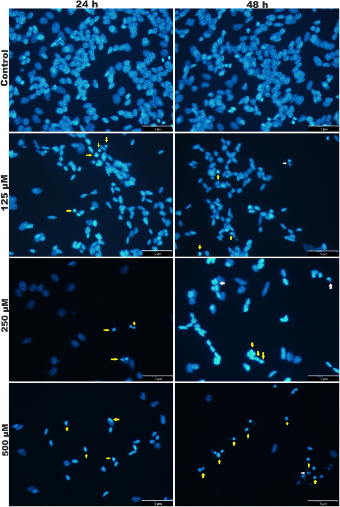 Neurotoxic Effect Of Fipronil In Neuroblastoma Sh Sy5y Cell Line Springerlink