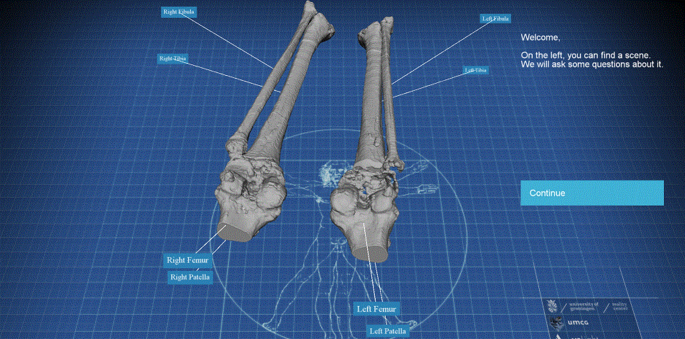 VeLight: A 3D virtual reality tool for CT-based anatomy teaching ...