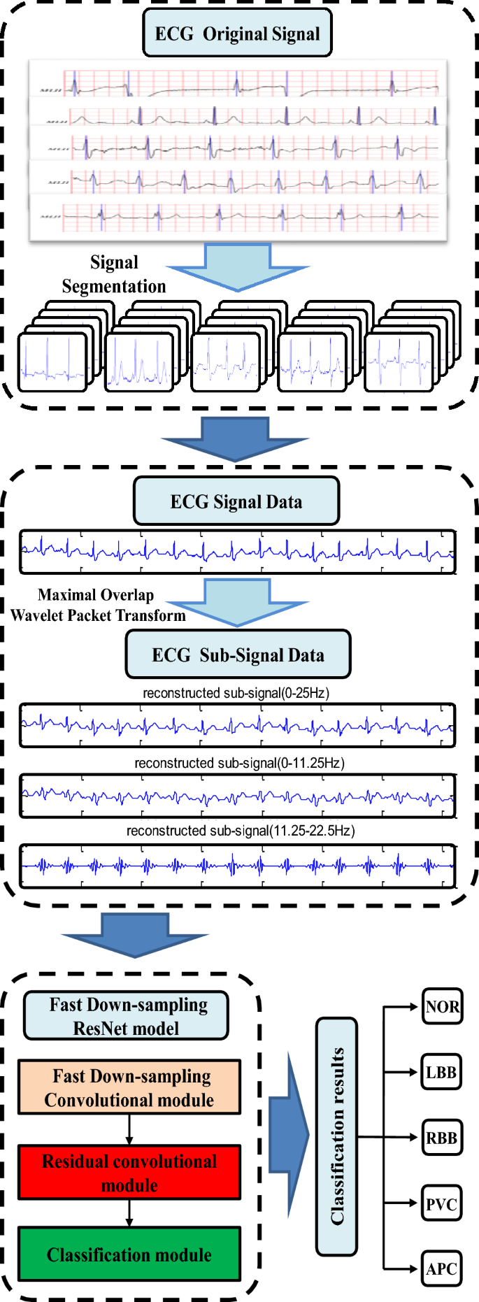 Accurate Classification Of Ecg Arrhythmia Using Mowpt Enhanced Fast Compression Deep Learning Networks Springerlink