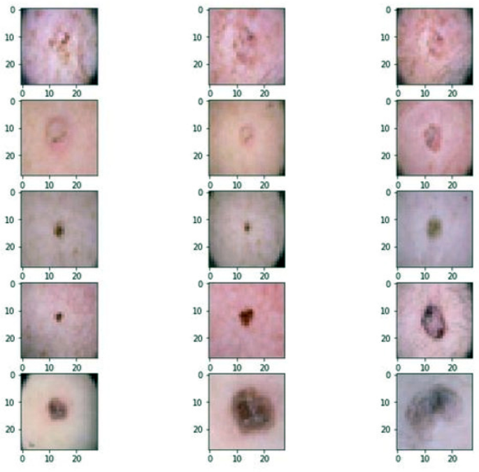 skin lesion classification using decision trees and random forest algorithms springerlink