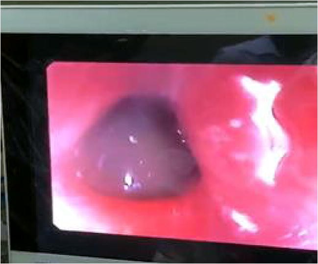 61st Annual Conference of Indian Society of Gastroenterology  