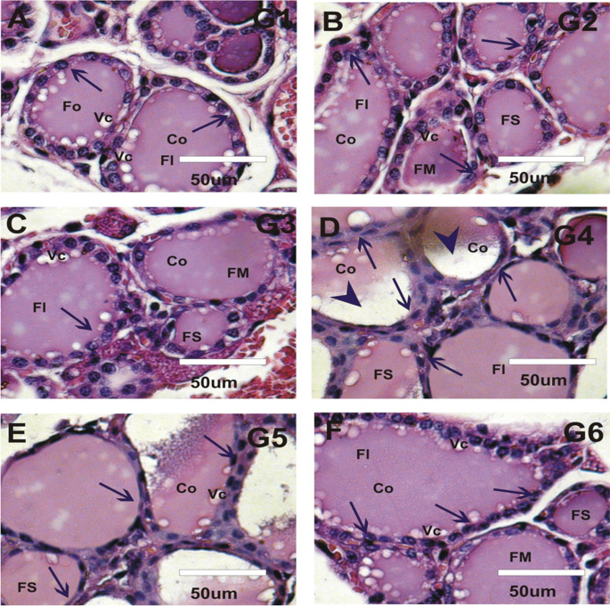 effect of glutathione on hyperthyroidism Inhibitory Impact Quercetin Nanoparticles Polyol Pathway in Rats | BioNanoScience Extra pure Gluta White body whitening Size:6 pack Supreme