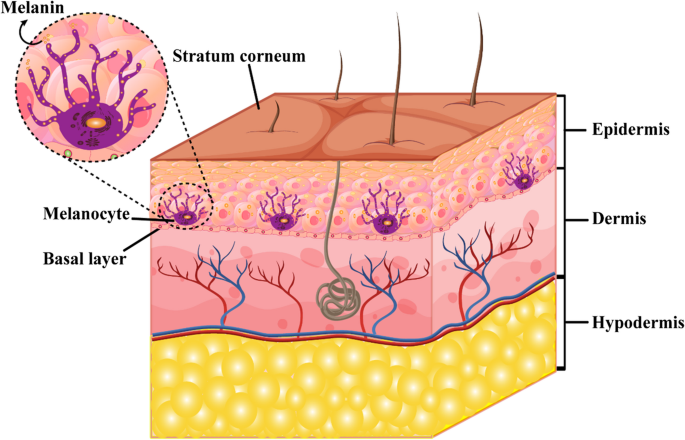 Innovative Photothermal Nanomaterials for Combating Melanoma ...