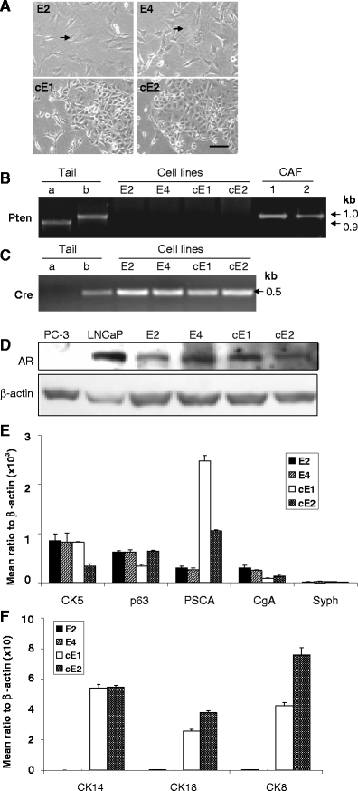 Mouse Prostate Cancer Cell Lines Established From Primary And Postcastration Recurrent Tumors Springerlink