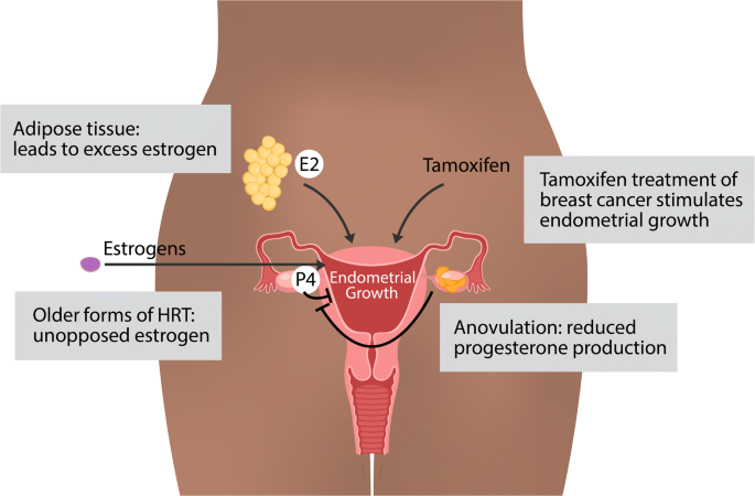 endometrial cancer estrogen