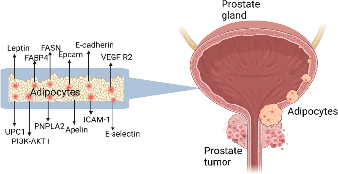 glp 1 and prostate cancer Targeting obesity, metabolic syndrome, and prostate cancer: GLP-1 agonists  as emerging therapeutic agents | Discover Oncology