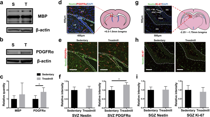 Treadmill Exercise Suppresses Cognitive Decline And Increases White Matter Oligodendrocyte Precursor Cells In A Mouse Model Of Prolonged Cerebral Hypoperfusion Springerlink