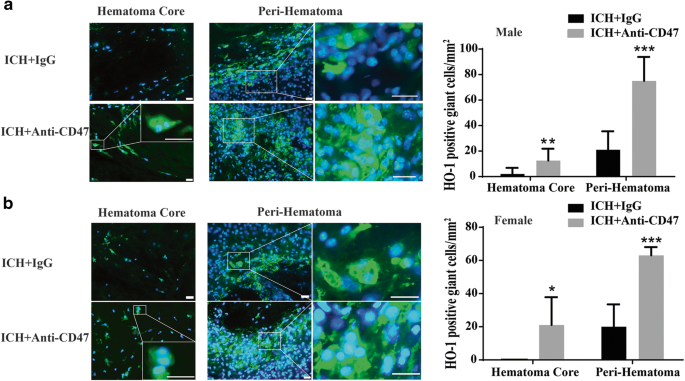 Multinucleated Giant Cells In Experimental Intracerebral Hemorrhage Springerlink
