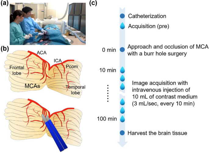 The Hyperacute Phase of Cerebral Infarction in a Swine Model ...