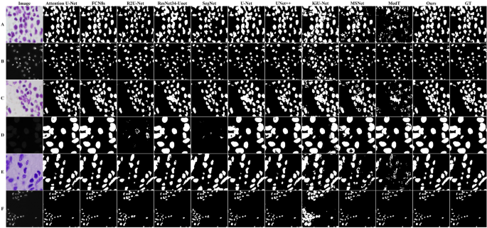 figure 17