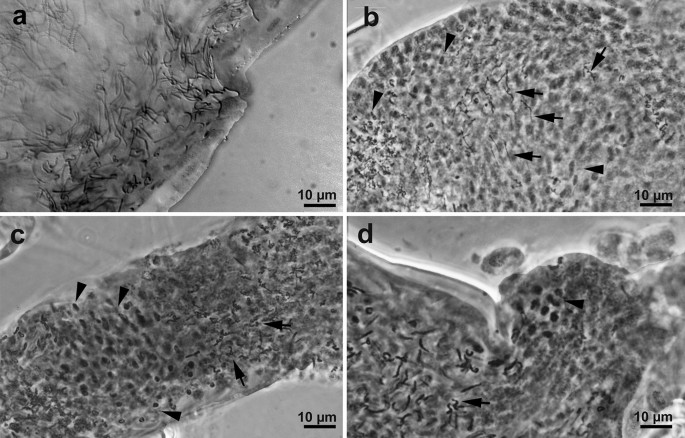 Micrathyria pseudeximia: (1) Aspecto geral da exúvia de último estádio.