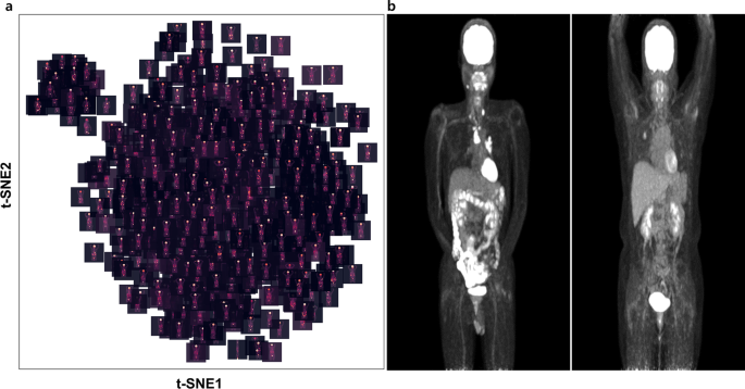 Deep learning-based segmentation of the thorax in mouse micro-CT scans