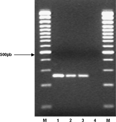 Agarose gel electrophoresis of crude DNA (F1 & G1) and universal PCR