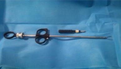 Falope Ring or Modified Pomeroy's Technique for Concurrent Tubal  Sterilization | SpringerLink