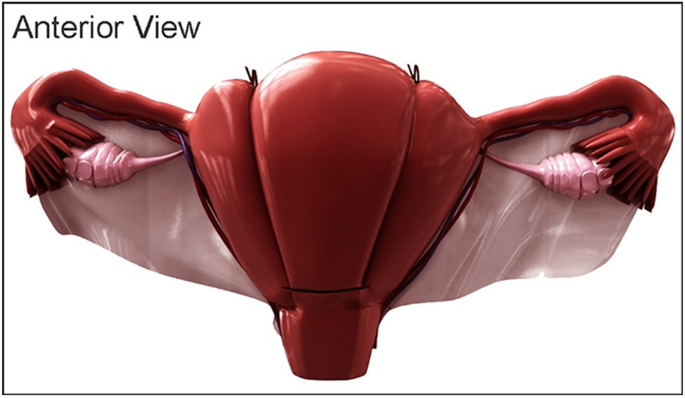 Comoc Mg Stitch Modification Of B Lynch Suturing Technique To Control Atonic Post Partum Haemorrhage Springerlink