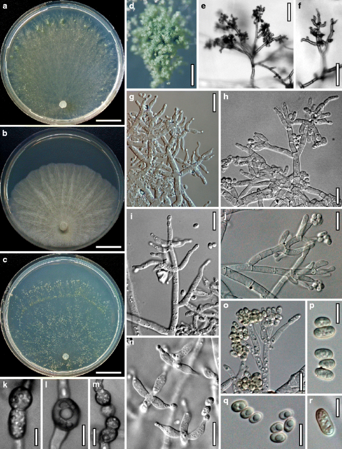 figure 29