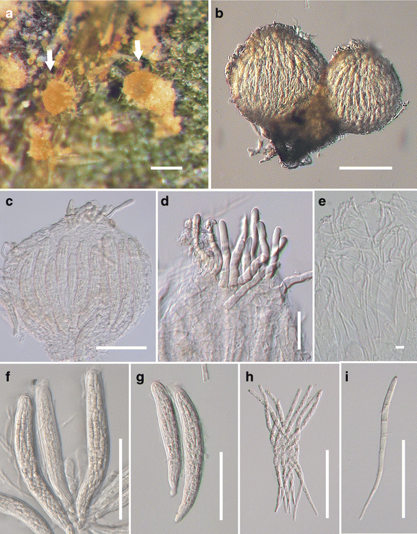 figure 35