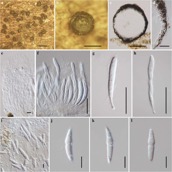Fungal diversity notes 1–110: taxonomic and phylogenetic contributions to  fungal species | SpringerLink