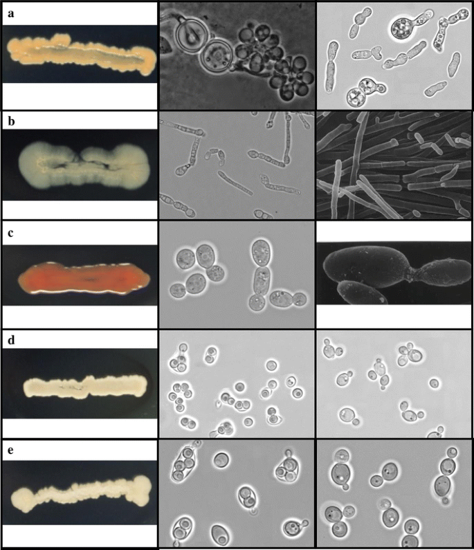 figure 18