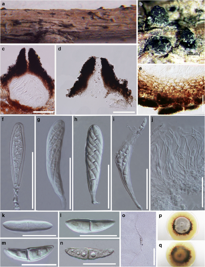 figure 32