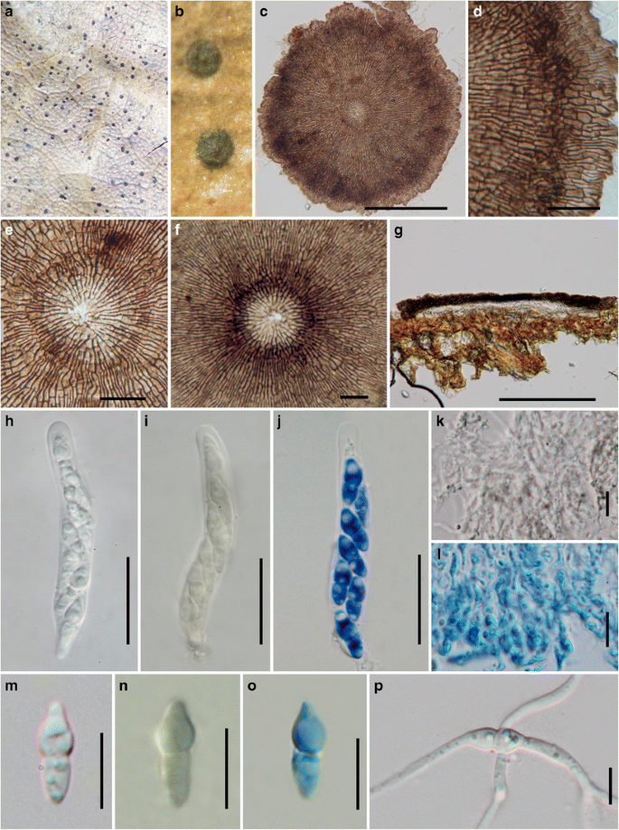 Fungal Diversity Notes 111 252 Taxonomic And Phylogenetic Contributions To Fungal Taxa Springerlink